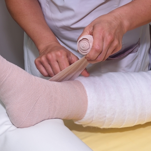 lymphedema-aurora-physical-therapy-aurora-ne