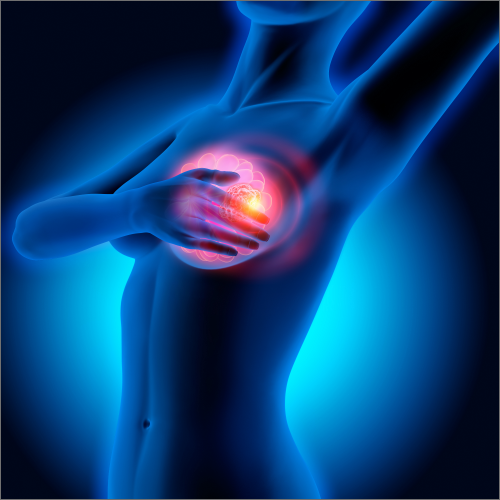 Breast-Cancer-Rehabilitation-Central-Nebraska-balance-mobility-lincoln-cancer-center-lincoln-ne