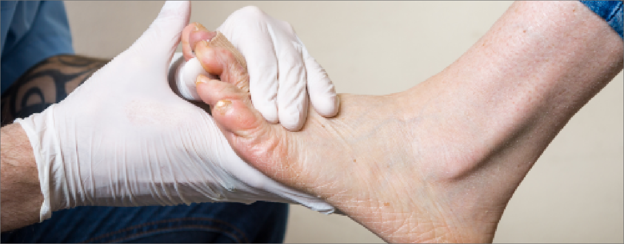 Orthotics-Central-Nebraska