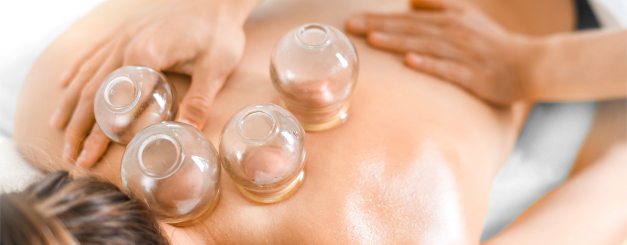 Cupping-St.-Elizabeth-Sport-and-Physical-Theapy-Lincoln-NE