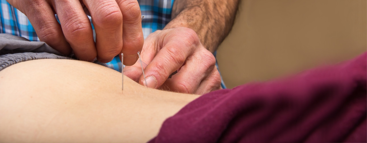 Dry-Needling-St.-Elizabeth-Sport-and-Physical-Theapy-Lincoln-NE