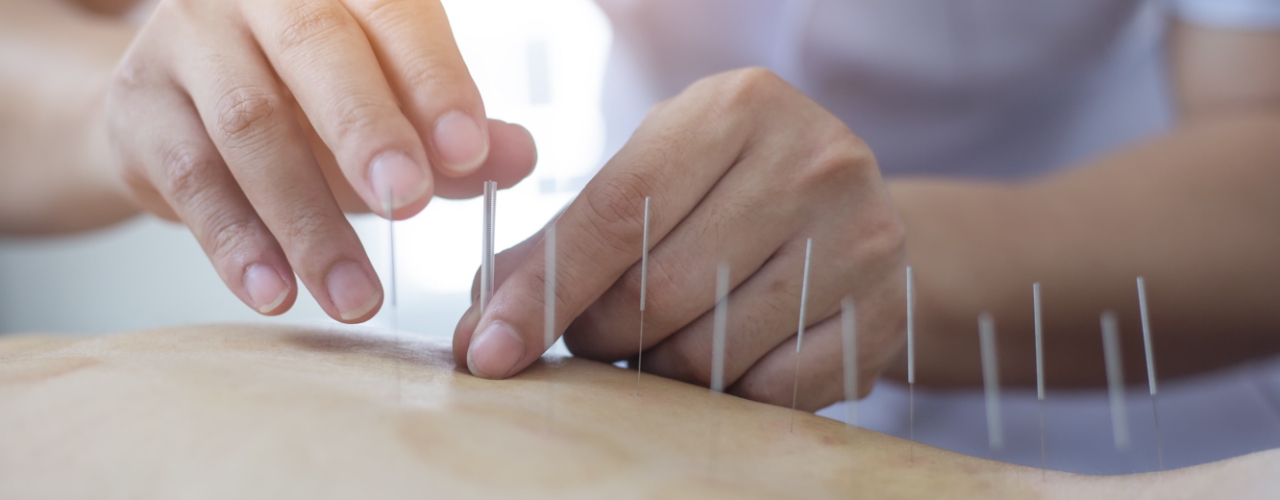 Dry-Needling-Womens-Health-and-Healing-Center-Grand-Island-NE