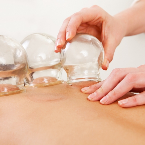 Cupping-Womens-Health-and-Healing-Center-Grand-Island-NE