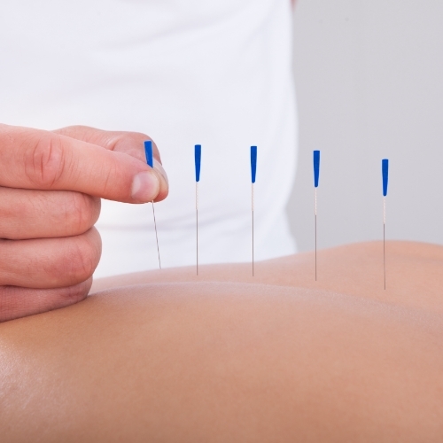 Dry-Needling-Womens-Health-and-Healing-Center-Grand-Island-NE